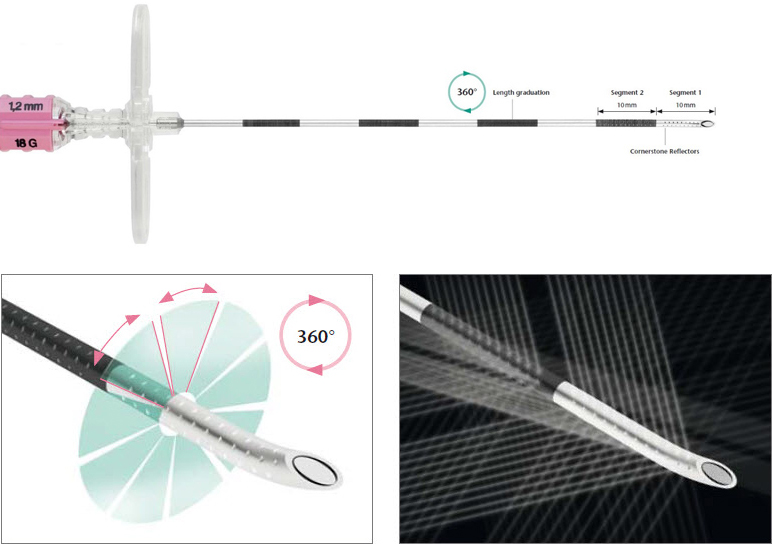 Regional Anesthesia